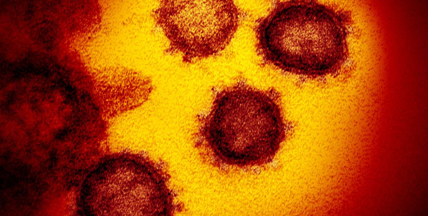 obraz nanostruktury na ekranie mikroskopu ekran komputera pokazujący powiększony obraz nanostruktury metalu