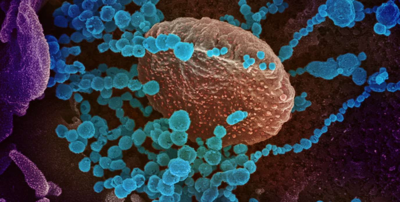 kolumna mikroskopu elektronowego w zbliżeniu detal stalowej kolumny mikroskopu z lampą elektronową i soczewkami